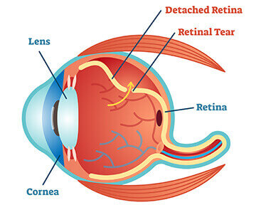 retina group of florida